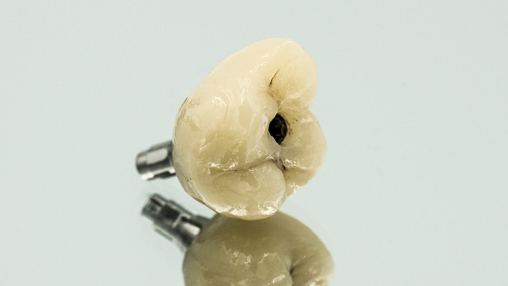 implant